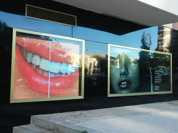 Pantalla de Led en Clinica dental de Madrid